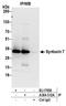 Syntaxin 7 antibody, A304-512A, Bethyl Labs, Immunoprecipitation image 