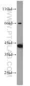 ADP Ribosylation Factor Like GTPase 13B antibody, 17711-1-AP, Proteintech Group, Western Blot image 
