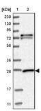 Glutathione S-Transferase Mu 3 antibody, NBP1-83323, Novus Biologicals, Western Blot image 