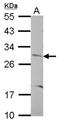 CCR4-NOT Transcription Complex Subunit 8 antibody, NBP2-15930, Novus Biologicals, Western Blot image 