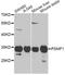 Proteasome Inhibitor Subunit 1 antibody, A5554, ABclonal Technology, Western Blot image 
