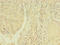 Thyroid Hormone Receptor Beta antibody, LS-C370425, Lifespan Biosciences, Immunohistochemistry paraffin image 