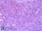 C-C Motif Chemokine Receptor 7 antibody, LS-A748, Lifespan Biosciences, Immunohistochemistry frozen image 