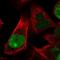 Holliday Junction Recognition Protein antibody, NBP2-58281, Novus Biologicals, Immunocytochemistry image 