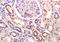 Sodium Channel Epithelial 1 Beta Subunit antibody, orb4659, Biorbyt, Immunohistochemistry paraffin image 
