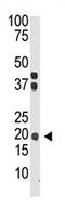 Interferon Lambda 2 antibody, AP11656PU-N, Origene, Western Blot image 