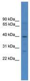 SRY-Box 1 antibody, TA343572, Origene, Western Blot image 