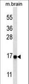 Microtubule Associated Protein 1 Light Chain 3 Alpha antibody, LS-C159363, Lifespan Biosciences, Western Blot image 