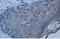 Keratin 1 antibody, ab93652, Abcam, Immunohistochemistry paraffin image 