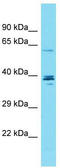 Coiled-Coil Domain Containing 149 antibody, TA333459, Origene, Western Blot image 
