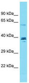 Coiled-Coil Domain Containing 149 antibody, TA333459, Origene, Western Blot image 