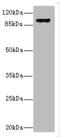 Integrin Subunit Beta 1 antibody, A62802-100, Epigentek, Western Blot image 