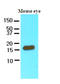 Cellular Retinoic Acid Binding Protein 2 antibody, AM09062PU-S, Origene, Western Blot image 