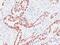 RB Transcriptional Corepressor 1 antibody, GTX34994, GeneTex, Immunohistochemistry paraffin image 