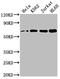 Histone Deacetylase 1 antibody, CSB-RA299884A0HU, Cusabio, Western Blot image 