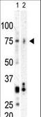 Polo Like Kinase 3 antibody, LS-C101121, Lifespan Biosciences, Western Blot image 