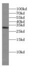 CD154 / CD40L antibody, FNab01432, FineTest, Western Blot image 