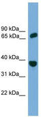Protection Of Telomeres 1 antibody, TA344380, Origene, Western Blot image 