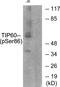 Lysine Acetyltransferase 5 antibody, PA5-38424, Invitrogen Antibodies, Western Blot image 