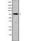 Fibulin 1 antibody, abx215310, Abbexa, Western Blot image 