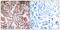 Protein Kinase AMP-Activated Catalytic Subunit Alpha 1 antibody, GTX50863, GeneTex, Immunohistochemistry paraffin image 