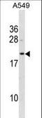 Biliverdin Reductase B antibody, LS-C157583, Lifespan Biosciences, Western Blot image 