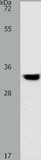 Tropomyosin 2 antibody, TA322872, Origene, Western Blot image 