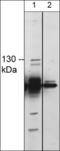 Transient Receptor Potential Cation Channel Subfamily M Member 8 antibody, TP5701, ECM Biosciences, Western Blot image 