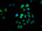 CAP-Gly Domain Containing Linker Protein 2 antibody, LS-C680291, Lifespan Biosciences, Immunofluorescence image 