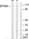 EPH Receptor B4 antibody, TA311685, Origene, Western Blot image 