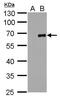 Coagulation Factor X antibody, GTX629480, GeneTex, Western Blot image 