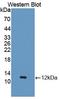 C-C Motif Chemokine Ligand 5 antibody, LS-C373897, Lifespan Biosciences, Western Blot image 