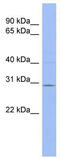 Tripartite motif-containing protein 14 antibody, TA345475, Origene, Western Blot image 