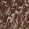 Dihydrouridine Synthase 1 Like antibody, HPA023384, Atlas Antibodies, Immunohistochemistry paraffin image 