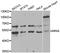 Ribosomal Oxygenase 2 antibody, STJ28738, St John