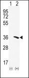 N-Acetyltransferase 2 antibody, LS-C164755, Lifespan Biosciences, Western Blot image 
