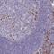 BCL2 Associated Agonist Of Cell Death antibody, HPA062105, Atlas Antibodies, Immunohistochemistry frozen image 