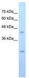 Solute Carrier Family 48 Member 1 antibody, TA344145, Origene, Western Blot image 