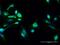 Phosphatidylinositide phosphatase SAC1 antibody, H00022908-D01P, Novus Biologicals, Immunofluorescence image 