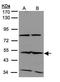 ISG-54 K antibody, GTX108346, GeneTex, Western Blot image 