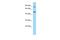 Vasorin antibody, A08469, Boster Biological Technology, Western Blot image 