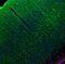 C-C Motif Chemokine Ligand 5 antibody, GTX31207, GeneTex, Immunohistochemistry frozen image 