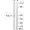 T-cell acute lymphocytic leukemia protein 1 antibody, A00944, Boster Biological Technology, Western Blot image 