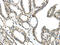 Mediator Complex Subunit 18 antibody, CSB-PA995695, Cusabio, Immunohistochemistry paraffin image 