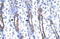 Matrix Metallopeptidase 19 antibody, 27-548, ProSci, Enzyme Linked Immunosorbent Assay image 
