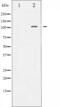 Nuclear Factor Of Activated T Cells 3 antibody, GTX52339, GeneTex, Western Blot image 