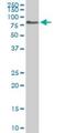 Acyl-CoA Binding Domain Containing 3 antibody, H00064746-M01, Novus Biologicals, Western Blot image 