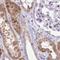 Dihydrouridine Synthase 2 antibody, NBP1-91852, Novus Biologicals, Immunohistochemistry paraffin image 