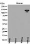 NEDD4 Like E3 Ubiquitin Protein Ligase antibody, M01595, Boster Biological Technology, Western Blot image 