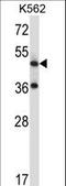 Tachykinin Receptor 3 antibody, LS-C161681, Lifespan Biosciences, Western Blot image 